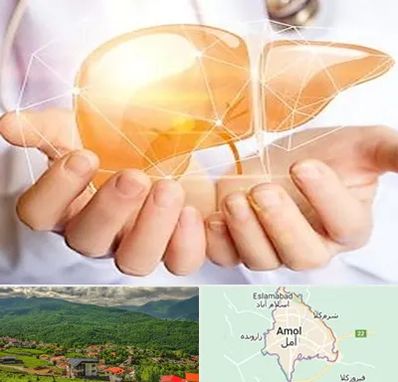 دکتر سرطان کبد در آمل