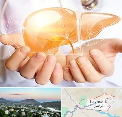 دکتر سرطان کبد در لواسان