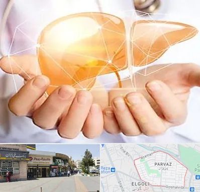 دکتر سرطان کبد در پرواز تبریز