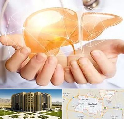 دکتر سرطان کبد در نجف آباد