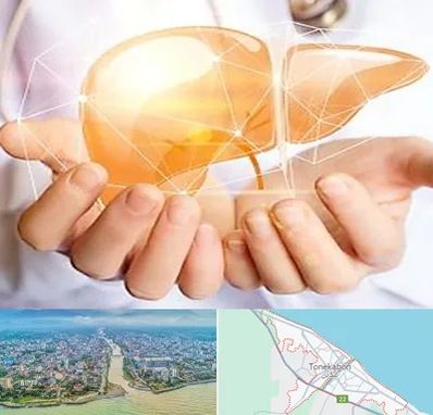 دکتر سرطان کبد در تنکابن