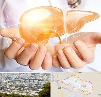 دکتر سرطان کبد در یاسوج