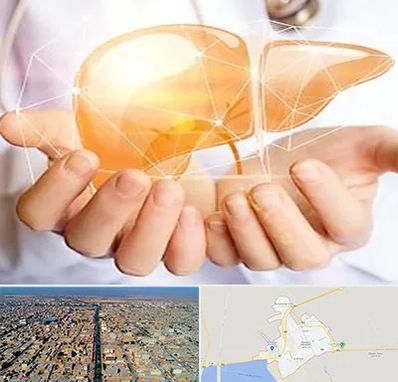 دکتر سرطان کبد در بندر ماهشهر