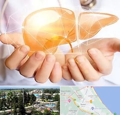 دکتر سرطان کبد در رودسر