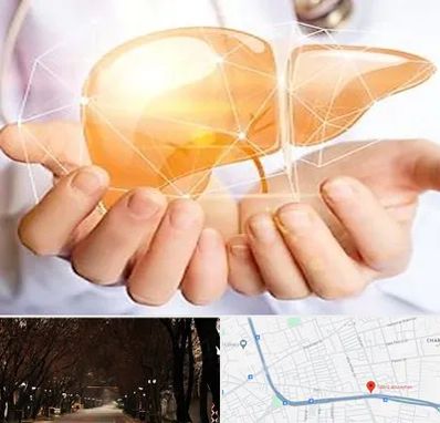 دکتر سرطان کبد در ابوریحان تبریز