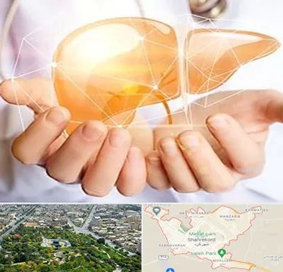 دکتر سرطان کبد در شهرکرد