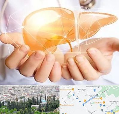 دکتر سرطان کبد در محلاتی شیراز 