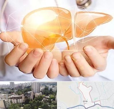 دکتر سرطان کبد در اوین