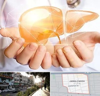 دکتر سرطان کبد در خیابان جمالزاده