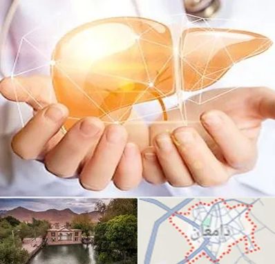 دکتر سرطان کبد در دامغان