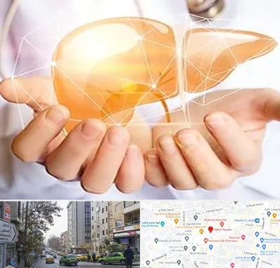 دکتر سرطان کبد در فاطمی 