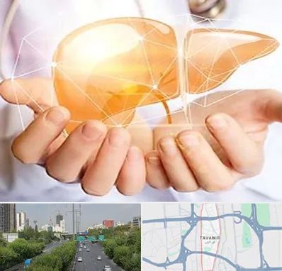 دکتر سرطان کبد در توانیر