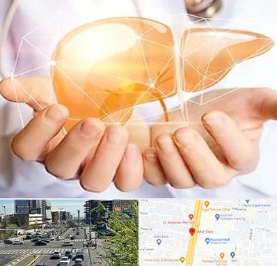 دکتر سرطان کبد در ستاری 