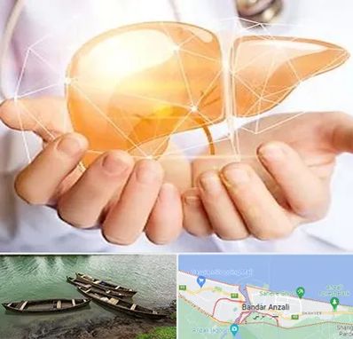 دکتر سرطان کبد در بندر انزلی