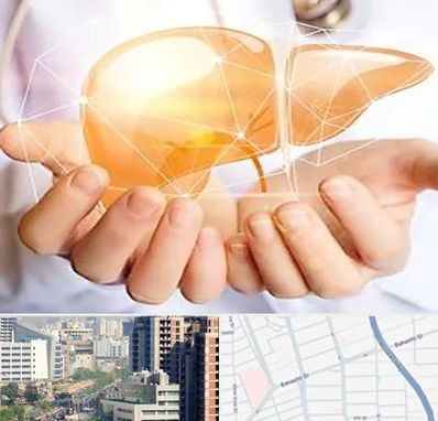 دکتر سرطان کبد در خیابان بهشتی