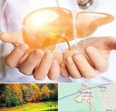 دکتر سرطان کبد در کردکوی