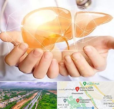 دکتر سرطان کبد در قصرالدشت شیراز 