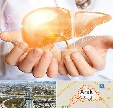دکتر سرطان کبد در اراک