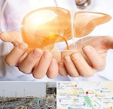 دکتر سرطان کبد در بلوار توس مشهد 