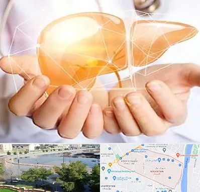 دکتر سرطان کبد در گلستان اهواز 