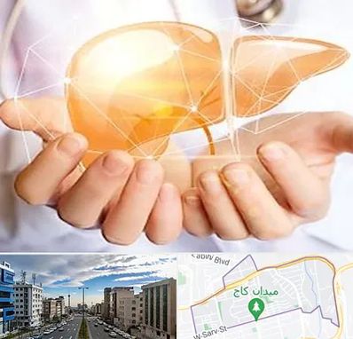 دکتر سرطان کبد در سعادت آباد 
