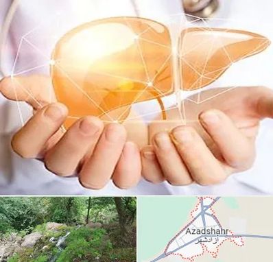 دکتر سرطان کبد در آزادشهر
