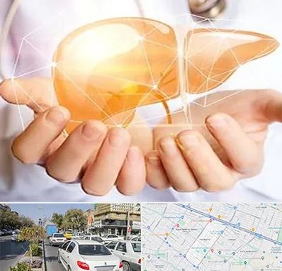 دکتر سرطان کبد در مفتح مشهد 