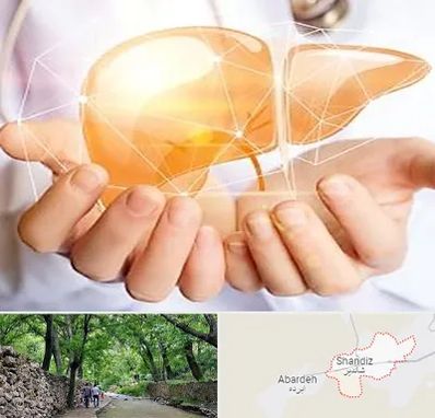 دکتر سرطان کبد در شاندیز مشهد