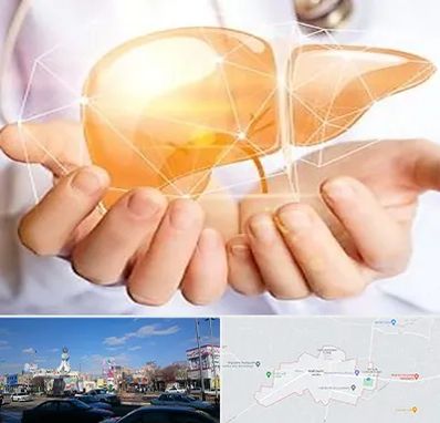 دکتر سرطان کبد در ماهدشت کرج 