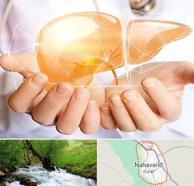 دکتر سرطان کبد در نهاوند