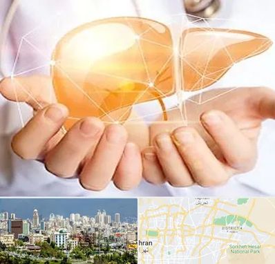 دکتر سرطان کبد در شرق تهران 