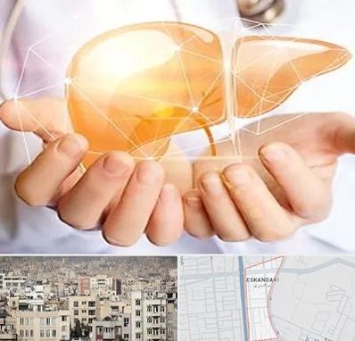 دکتر سرطان کبد در اسکندری