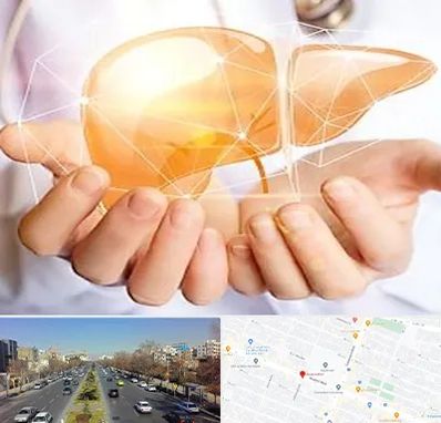 دکتر سرطان کبد در بلوار معلم مشهد 