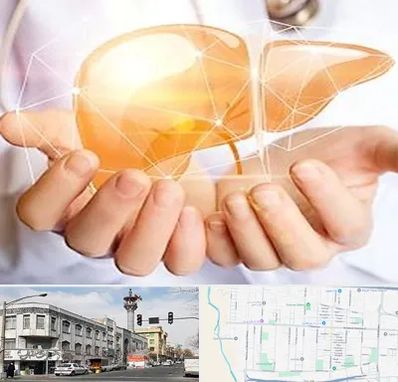 دکتر سرطان کبد در 17شهریور