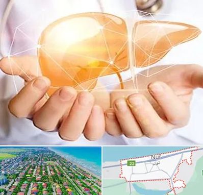 دکتر سرطان کبد در نور