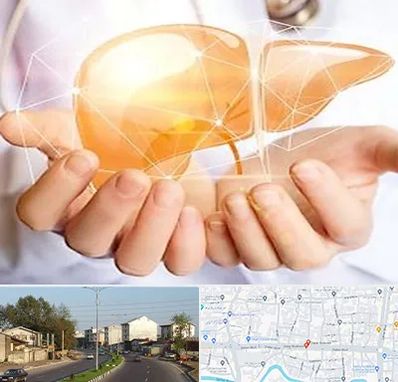 دکتر سرطان کبد در ضیابری رشت 