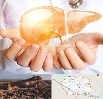 دکتر سرطان کبد در بم