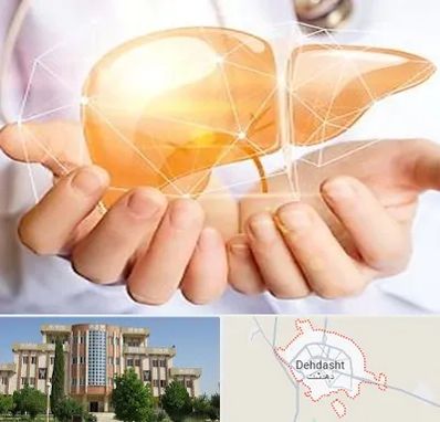 دکتر سرطان کبد در دهدشت