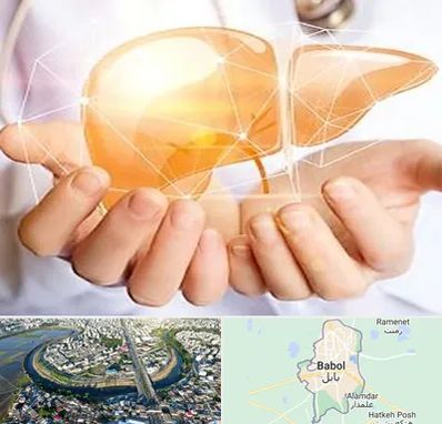 دکتر سرطان کبد در بابل