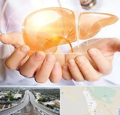 دکتر سرطان کبد در اندیمشک