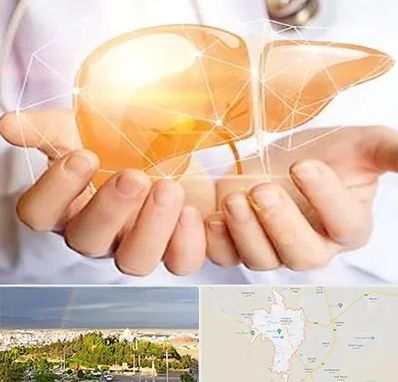 دکتر سرطان کبد در تربت حیدریه