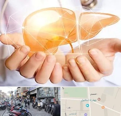 دکتر سرطان کبد در چهارراه استانبول