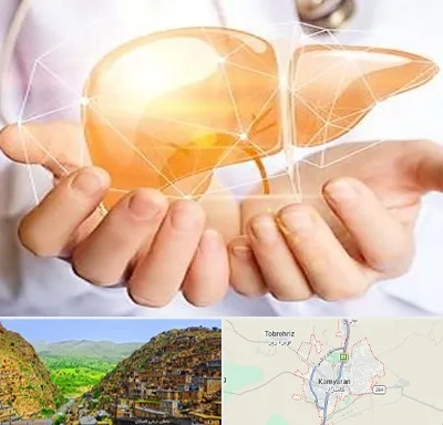 دکتر سرطان کبد در کامیاران