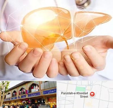 دکتر سرطان کبد در 15 خرداد