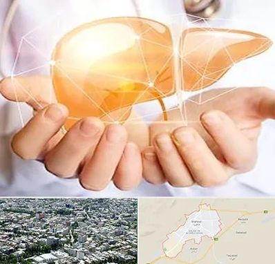 دکتر سرطان کبد در شاهرود