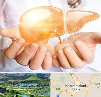 دکتر سرطان کبد در خرم آباد