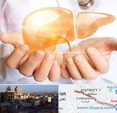 دکتر سرطان کبد در فرمانیه 