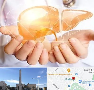 دکتر سرطان کبد در فلکه گاز شیراز 