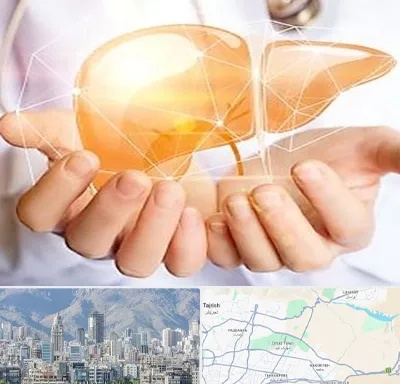 دکتر سرطان کبد در شمال شرق تهران