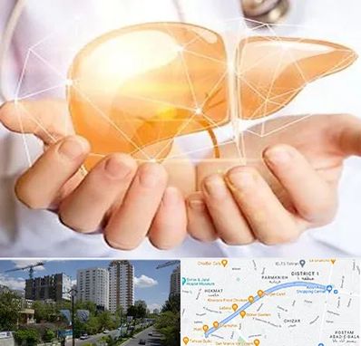 دکتر سرطان کبد در اندرزگو 